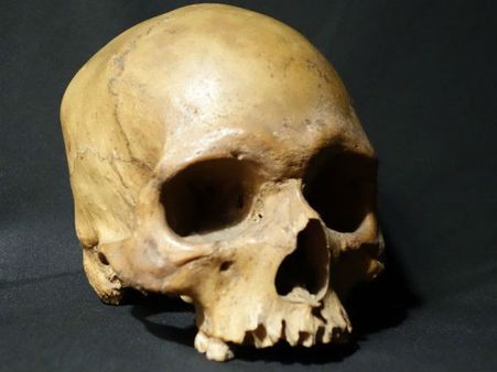 160 വര്‍ഷം പഴക്കമുള്ള തലയോട്ടി; ലഭിച്ചത് മദ്യശാലയില്‍ നിന്ന്, ഇന്ത്യയെയും ബ്രിട്ടനെയും അലട്ടി!!