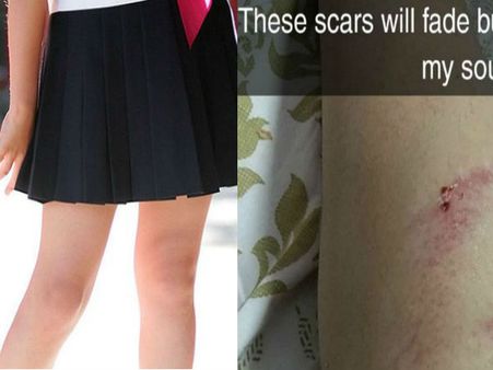 മോഡലായ യുവതിയെ നടുറോഡിൽ അപമാനിച്ചു! അടിയിൽ എന്താണെന്ന് കാണട്ടെയെന്ന് പറഞ്ഞ് യുവാക്കളുടെ അതിക്രമം