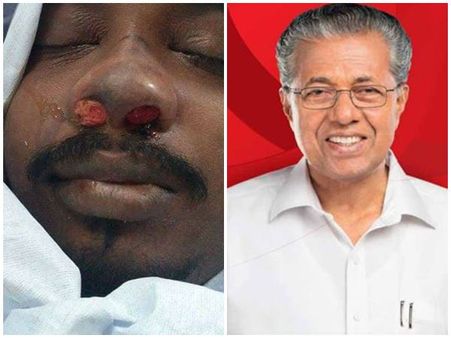 ശ്രീജിത്തിനെ അറസ്റ്റ് ചെയ്തത് കാവിയുടുത്ത പോലീസ്.. വാ തുറക്കാത്ത മുഖ്യമന്ത്രിക്കെതിരെ ചെന്നിത്തല