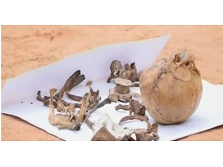 തിരുവനന്തപുരം ടെക്നോസിറ്റിയിൽ ഉപേക്ഷിച്ച തലയോട്ടി: തുമ്പുകിട്ടാതെ പോലീസ്