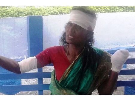 മറയൂരില്‍ വീട്ടമ്മയെ വെട്ടി കൊലപ്പെടുത്താന്‍ ശ്രമം: സംഭവത്തിന് പിന്നില്‍ കുടുംബവഴക്ക്!!