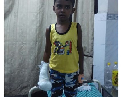 പറവൂര്‍ അംബേദ്ക്കര്‍ പാര്‍ക്കില്‍ അപകടങ്ങള്‍ പതിവാകുന്നു