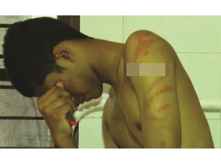 തൃശൂര്‍ ചൂലൂര്‍ അറബിക് കോളേജില്‍ വിദ്യാര്‍ത്ഥിക്ക് അദ്ധ്യാപകരുടെ ക്രൂരമര്‍ദ്ദനം