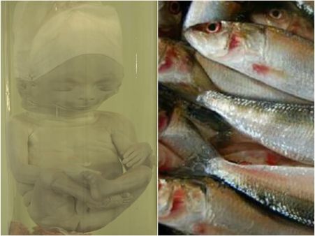 മൃതദേഹം 6 മാസമെങ്കില്‍ ഫോര്‍മാലിനില്‍ മത്സ്യം എത്ര നാള്‍; കാന്‍സറിന് വരെ കാരണമാകുന്ന ഫോര്‍മാലിന്‍