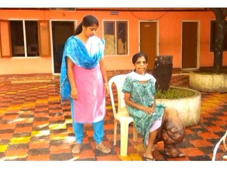 കാലില്‍ ശരീരത്തെക്കാള്‍ ഭാരമുള്ള മുഴകള്‍: യുവതി ചികിത്സാ സഹായം തേടുന്നു, ന്യൂറോ ഫൈബ്രോമെറ്റാസിസ്!