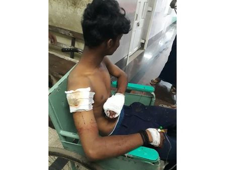 തിരുവനന്തപുരത്ത് മെഡിക്കൽ കോളേജ് ഹയർസെക്കന്ററി സ്കൂൾ വിദ്യാർഥികൾക്ക് കുത്തേറ്റു