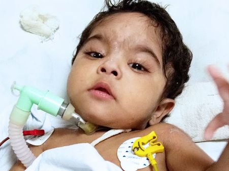 ഒരു വയസ്സുള്ള ഈ കുട്ടി ഓരോ ശ്വാസത്തിനുവേണ്ടിയും ക്ലേശിക്കുന്നു