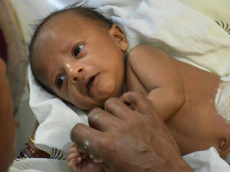 8 മാസം പ്രായമുള്ള അനിരുദ്ധിന്റെ ശസ്ത്രക്രിയയ്ക്കു സഹായിക്കൂ...