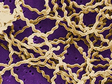 പനിവന്നാല്‍ സ്വയം ചികിത്സ പാടില്ലെന്ന് ഡിഎംഒ എലിപ്പനി സാധ്യത കണക്കിലെടുത്ത് അടിയന്തിര നിര്‍ദ്ദേശം