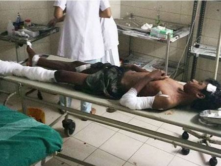 വീട്ടില്‍ ബോംബ് സ്‌ഫോടനം: കണ്ണൂരിലെ ആര്‍എസ്എസ് നേതാവ് കോടതിയില്‍ കീഴടങ്ങി