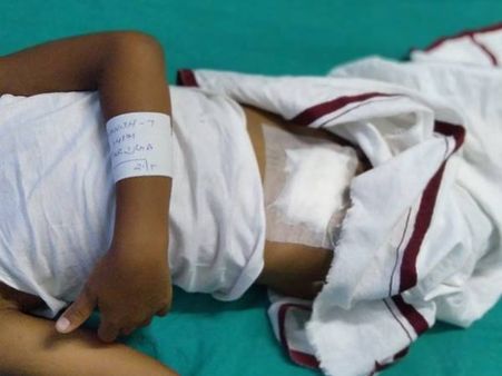 ഏഴുവയസ്സുകാരനെ ആളുമാറി ശസ്ത്രക്രിയ നടത്തിയ സംഭവത്തില്‍ നഷ്ടപരിഹാരം നല്‍കണമെന്ന് ഉമ്മര്‍ എം.എല്‍.എ