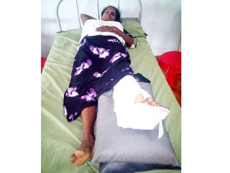 വീട്ടമ്മയെ കാട്ടുപന്നി ആക്രമിച്ചു: സംഭവം കോഴിക്കോട് കൂരാച്ചുണ്ടില്‍, ഓടിയ പന്നി കിണറ്റില്‍ വീണു!!