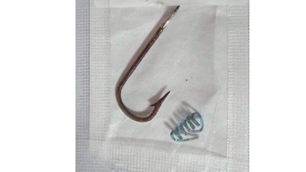 ആലപ്പുഴയിൽ വീട്ടമ്മയുടെ കണ്ണിൽ ചൂണ്ട തുളച്ചു കയറി; കാഴ്ച നഷ്‌ടപ്പെടാതെയും മുറിവേൽക്കാതെയും ശസ്ത്രക്രിയ!!