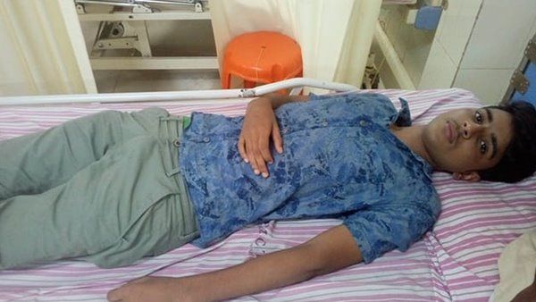 മുക്കം മണാശ്ശേരി സ്കൂളിൽ റാഗിംഗ്; ജൂനിയർ വിദ്യാർത്ഥിയെ ക്രൂരമായ മർദ്ദിച്ചു, ശരീരമാസകലം പരിക്ക്