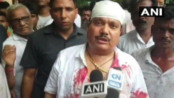 ബിജെപി നേതാക്കള്‍ക്കെതിരെ ലാത്തിച്ചാര്‍ച്ച്... ചോര വാര്‍ന്നൊലിച്ച് എംപി, ബംഗാളില്‍ സംഘര്‍ഷം!!