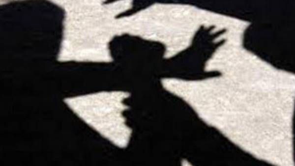 15കാരനെ തീകൊളുത്തിയെന്ന് ആരോപണം: സംഭവം ഉത്തര്‍പ്രദേശില്‍; നിഷേധിച്ച് പൊലീസ്