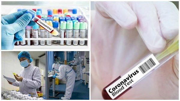 6 മാസത്തിനുള്ളില്‍ വാക്‌സിന്‍ റെഡി, ഓക്‌സ്‌ഫോര്‍ഡിന്റെ ഉറപ്പ്, ചൈനയും യുഎസ്സുമല്ല, ആത്മവിശ്വാസം!!