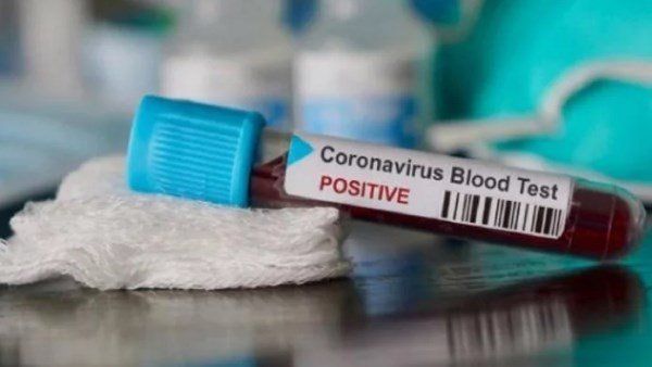 മൃതദേഹം സംസ്കരിക്കുന്നതിനെ ചൊല്ലി തർക്കം: കൊവിഡ് ബാധിതന്റെ സംസ്കാരം വൈകുന്നു!! സംഭവം തൃശ്ശൂരിൽ!!