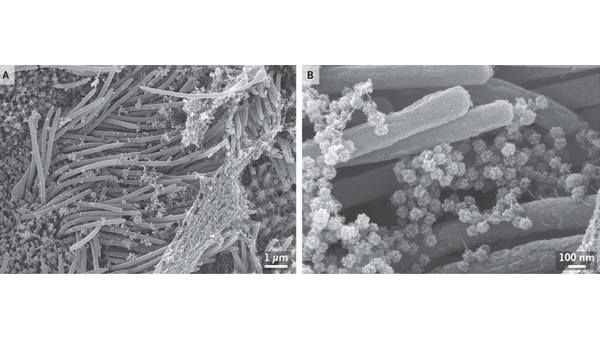 കൊറോണ വൈറസിന്റെ ചിത്രങ്ങൾ പുറത്ത് വിട്ട് ഗവേഷകർ: പകർത്തിയത് ശ്വാസകോശത്തിലെ അണുബാധ!!