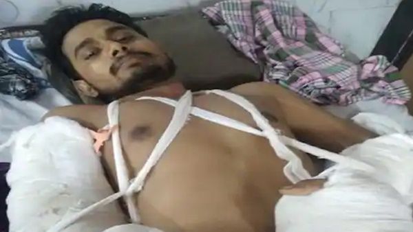 ദില്ലി കലാപത്തില്‍ യുവാവിന്‍റെ കൈ നഷ്ടപ്പെട്ടു; 'ആക്സിഡന്‍റ്' എന്ന് പൊലീസ് എഫ് ഐ ആര്‍