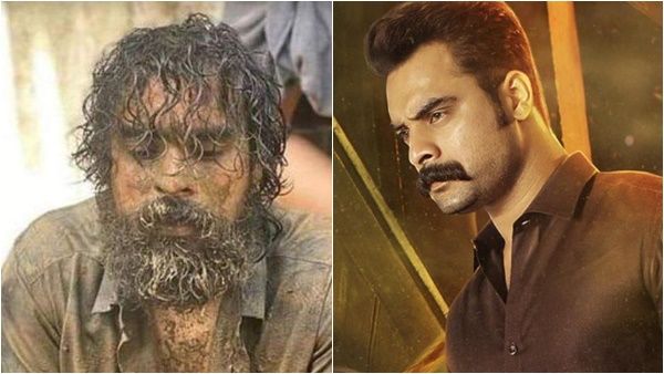 ടൊവിനോ തോമസിന് വീണ്ടും പരിക്ക്; ആദ്യം തീ വില്ലനായി,ഇപ്പോള്‍ വയറ്റിനേറ്റ ചവിട്ട്,ഐസിയുവില്‍ തുടരുന്നു