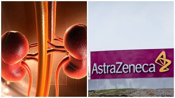 വൃക്ക രോഗികൾക്ക് ആശ്വാസം... ആസ്ട്രാസെനെക്കയുടെ ഡാപാഗ്ലിഫ്ളോസിന് ഇന്ത്യയിൽ അനുമതി