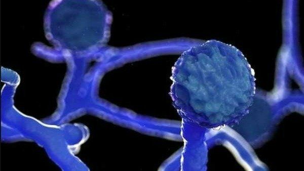 സ്റ്റിറോയിഡുകൾ ഫലപ്രദം,ബ്ലാക്ക് ഫംഗസുകൾക്ക് കാരണം അശാസ്ത്രീയ ഉപയോഗം; ഡോ വികെ പോൾ