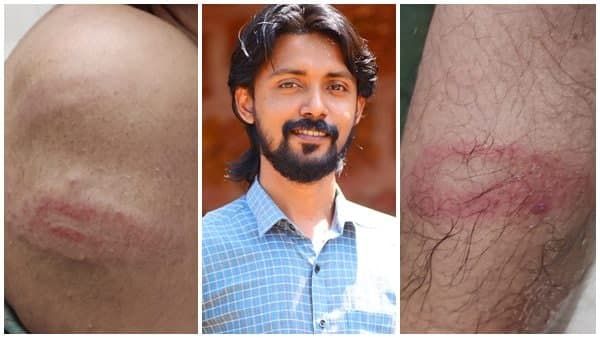 മുഖ്യമന്ത്രിയുടെ വാക്കിന് പുല്ലുവില; മാധ്യമപ്രവര്‍ത്തകനെ ആക്രമിച്ച സംഭവത്തില്‍ കേസെടുക്കാതെ പോലീസ്