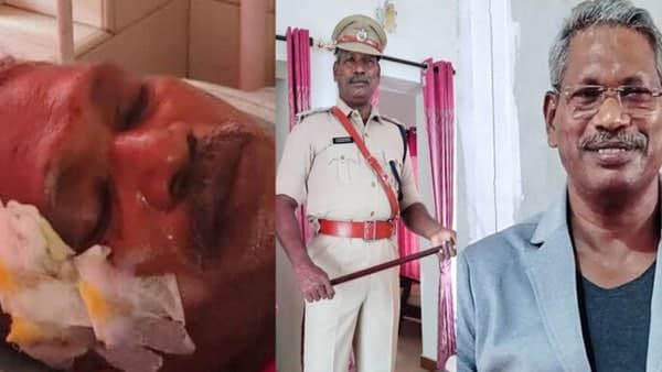 മുന്‍ ഡിവൈഎസ്പി രാധാകൃഷ്ണന് വാഹനാപകടത്തില്‍ പരിക്ക്; ദുരൂഹതയില്ലെന്ന് പൊലീസ്