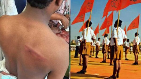 ഡിവൈഎഫ്‌ഐ നേതാവിനെ ആക്രമിച്ച ആർഎസ്എസ് പ്രവർത്തകനെ കസ്റ്റഡിയിലെടുത്ത് വിട്ടയച്ചു, വിചിത്ര വാദം...