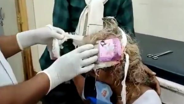 മുറിവുമായെത്തിയ യുവതിയുടെ തലയില്‍ കോണ്ടം പാക്കറ്റ്, അമ്പരന്ന് ഡോക്ടര്‍മാര്‍! വീഡിയോ...