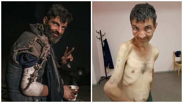 കൊടുംക്രൂരത, എല്ലും തോലുമായി സൈനികന്‍, റഷ്യ കൈമാറിയ തടവുകാരനെ കണ്ട് ഞെട്ടി യുക്രൈന്‍