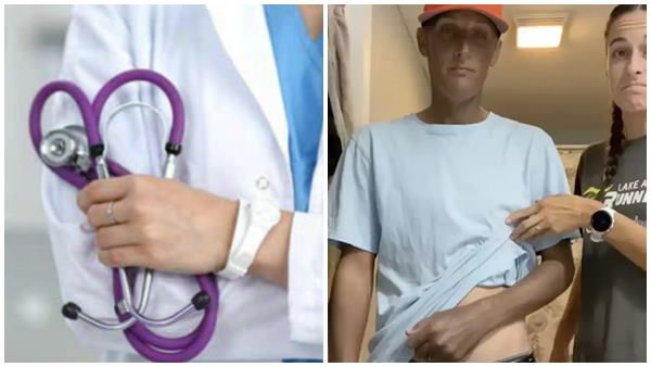 ഡോക്ടര്‍ മരുന്ന് നല്‍കി, യുവാവിന് സംഭവിച്ചത് വന്‍ മാറ്റം; വെയിലത്ത് ഇറങ്ങിയാല്‍ പണി കിട്ടും