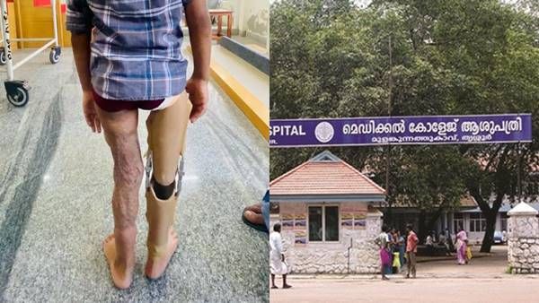 ഇനി നടക്കും കൃത്രിമ കാലിലൂടെ; അഞ്ചു വയസുകാരന്റെ സ്വപ്‌നം സഫലമാക്കി തൃശൂര്‍ മെഡിക്കല്‍ കോളേജ്