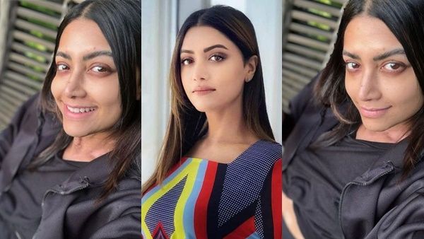 നിറം നഷ്ടപ്പെടുന്നുവെന്ന് മംമ്ത: കാന്‍സറിന് പിന്നാലെ പുതിയ രോഗം, എന്താണ് വിറ്റിലിഗോ