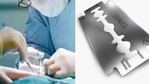 25 കാരന്റെ വയറ്റില്‍ 56 ബ്ലേഡുകള്‍; അമ്പരന്ന് ഡോക്ടര്‍മാര്‍..! ഒടുവില്‍ ആശ്വാസം