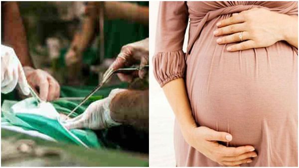 ഗര്‍ഭസ്ഥ ശിശുവില്‍ സര്‍ജറി, 90 സെക്കന്‍ഡില്‍ പൂര്‍ത്തിയാക്കി, അപൂര്‍വ നേട്ടവുമായി ഡോക്ടര്‍മാര്‍