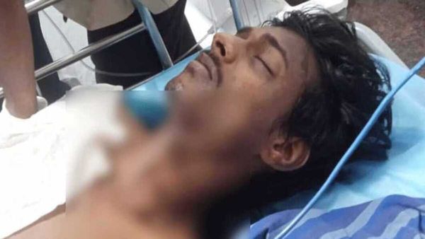 തലശേരി സ്‌ഫോടനം, ബോംബ് പൊട്ടിയത് നിര്‍മാണത്തിനിടെ, പരുക്കേറ്റയാള്‍ മൂന്ന് കേസുകളില്‍ പ്രതി