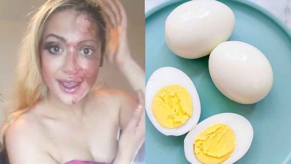 ടിക് ടോക്കിലെ വൈറല്‍ വിദ്യ ഉപയോഗിച്ച് മുട്ട പുഴുങ്ങാന്‍ നോക്കി; യുവതിക്ക് പിന്നീട് സംഭവിച്ചത് കണ്ടോ