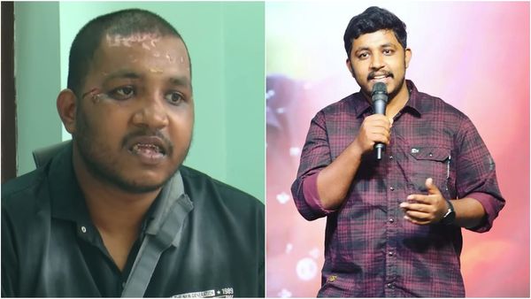 'പല്ല് പോയി, മൂക്കിലെ ചതവ് ശബ്ദം മാറ്റി മറിച്ചു': പക്ഷെ ശക്തമായി തിരിച്ച് വരും: മഹേഷ് കുഞ്ഞുമോന്‍