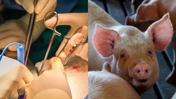 പന്നിയുടെ വൃക്ക മനുഷ്യന് മാറ്റിവെച്ചു; പരീക്ഷണം വിജയകരമെന്ന്