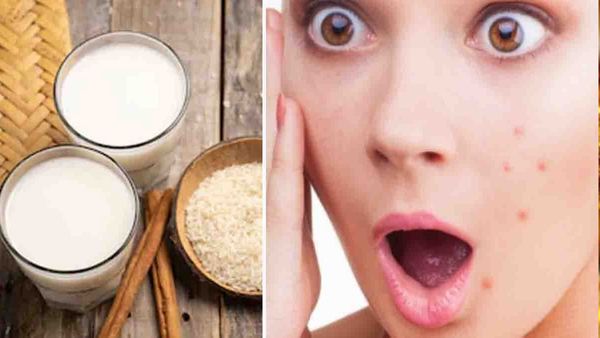 ഒരൊറ്റ കപ്പ് കഞ്ഞിവെള്ളം മതി... നിങ്ങളുടെ സൗന്ദര്യം ഇരട്ടിയാകും; ബ്യൂട്ടി പാര്‍ലറില്‍ കയറി കാശ് കളയേണ്ട!!