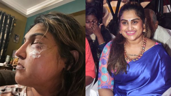 'അയാളുടെ ഭ്രാന്തൻ ചിരി ഇപ്പോഴും കാതിൽ മുഴങ്ങുന്നു...'; താൻ ആക്രമിക്കപ്പെട്ടതായി നടി വനിത