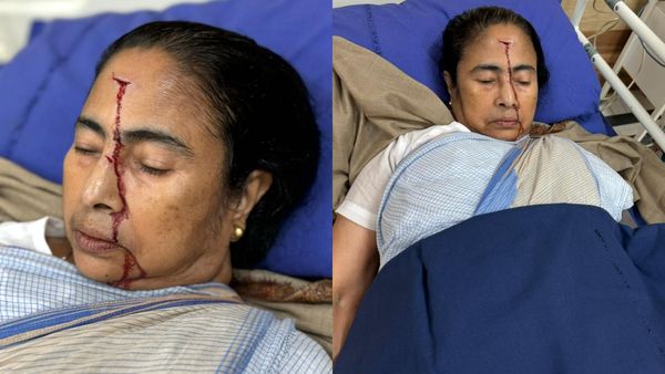 ബംഗാൾ മുഖ്യമന്ത്രി മമത ബാനർജി ആശുപത്രിയിൽ; തലയ്ക്ക് സാരമായ പരിക്ക്, ചിത്രങ്ങൾ പങ്കുവച്ച് തൃണമൂൽ