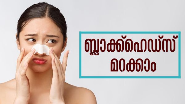 ബ്ലാക്ക്‌ഹെഡ്‌സ് മറന്നേക്കൂ... ഇനി പാര്‍ലറിലൊന്നും പോകേണ്ട; വീട്ടില്‍ തന്നെയുണ്ട് പരിഹാരം