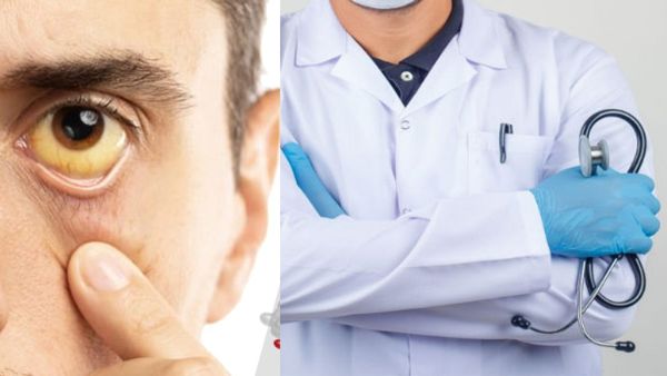 വേങ്ങൂരിലെ മഞ്ഞപ്പിത്ത രോഗ വ്യാപനം; അതീവ ജാഗ്രത, കടകള്‍ പൂട്ടിച്ചു