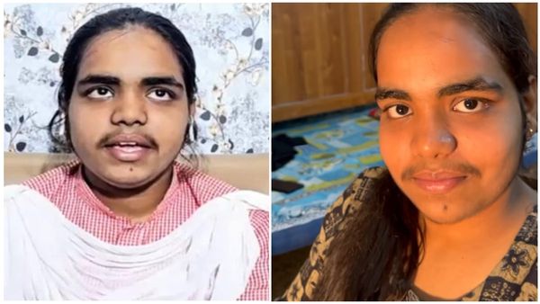 മുഖത്തെ രോമത്തിന്റെ പേരിൽ കളിയാക്കൽ; പ്രാചി നി​ഗത്തിന്റെ മേക്കോവർ വീഡിയോ, ഒടുവിൽ വൻ ട്വിസ്റ്റ്...