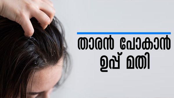താരനും തലയിലെ ചൊറിച്ചിലും മാറ്റിയെടുക്കാം; ഒരു നുള്ള് ഉപ്പ് മതി