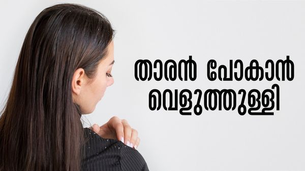 താരനാണോ നിങ്ങളുടെ പ്രശ്‌നം.. കീശ കാലിയാകാതെ മാറ്റാം; വെളുത്തുള്ളി എടുത്തോളൂ