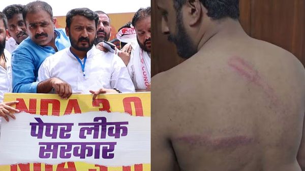 യൂത്ത് കോണ്‍ഗ്രസ് പ്രതിഷേധത്തില്‍ സംഘര്‍ഷം; രാഹുല്‍ മാങ്കൂട്ടത്തിലിനെ തല്ലിച്ചതച്ച് ഡല്‍ഹി പൊലീസ്